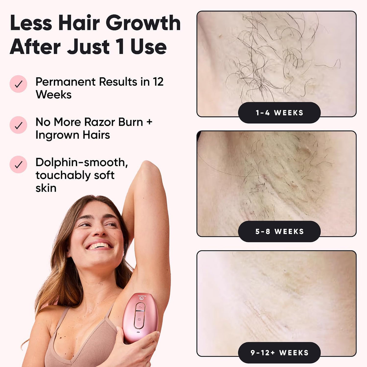 RoseSkinCo Lumi IPL Laser Hair Removal Device, At Home Permanent Hair Reduction on Face, Bikini, Legs, Arms, Underarms, Safe & Gentle Intense Pulsed Light Handheld Device, White/Gold