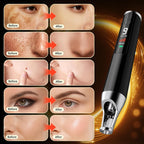 PicoSecond Nd: YAG System - Tattoo Removal Pen, 9-Level Compact Portable Tool with User-Friendly Operation – BPM-RA04